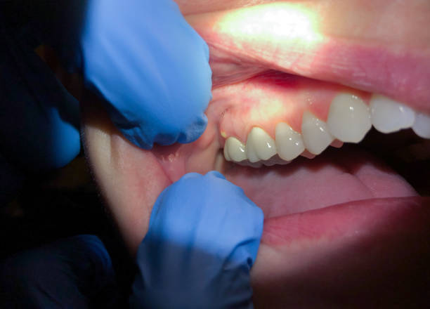 Best Urgent Tooth Repair  in Mayo, SC