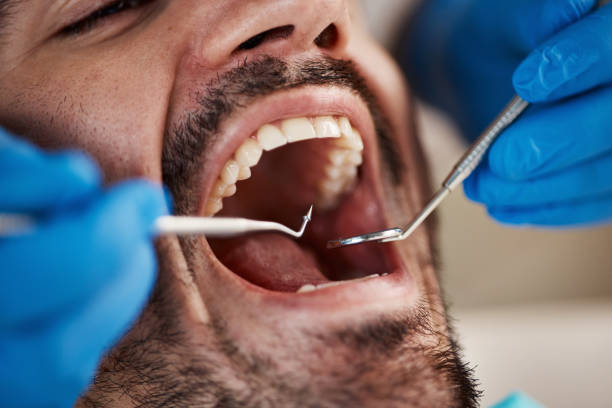 Best Knocked-Out Tooth Emergency  in Mayo, SC